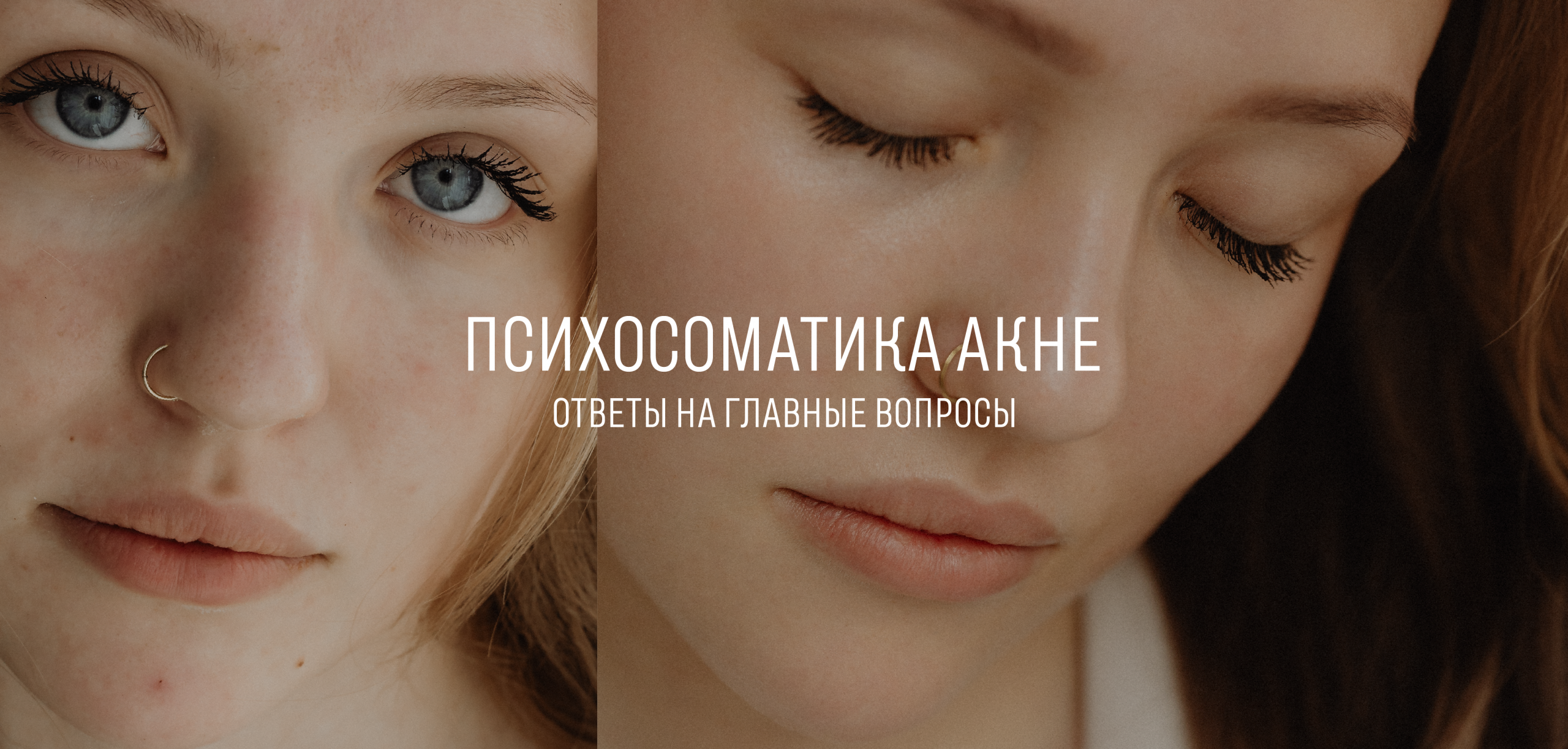 Психосоматика акне: ответы на главные вопросы