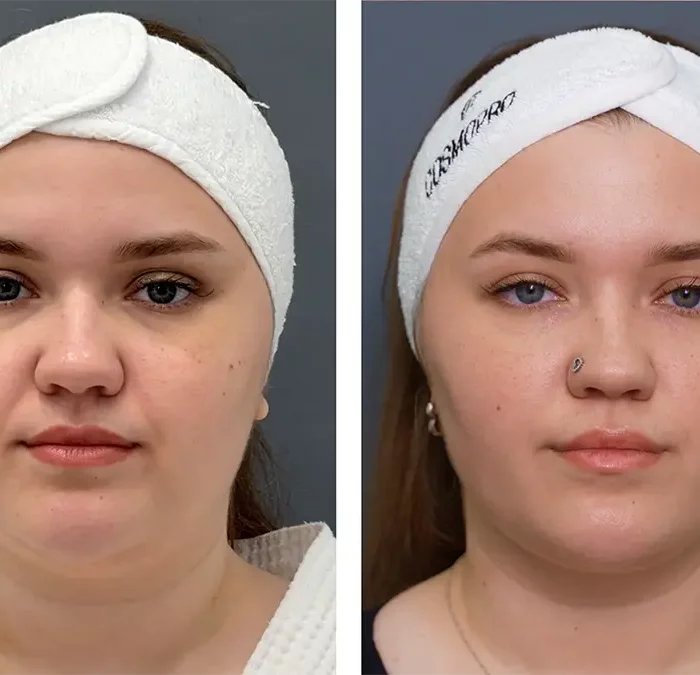 Ультраформер - Осколкова Анастасия