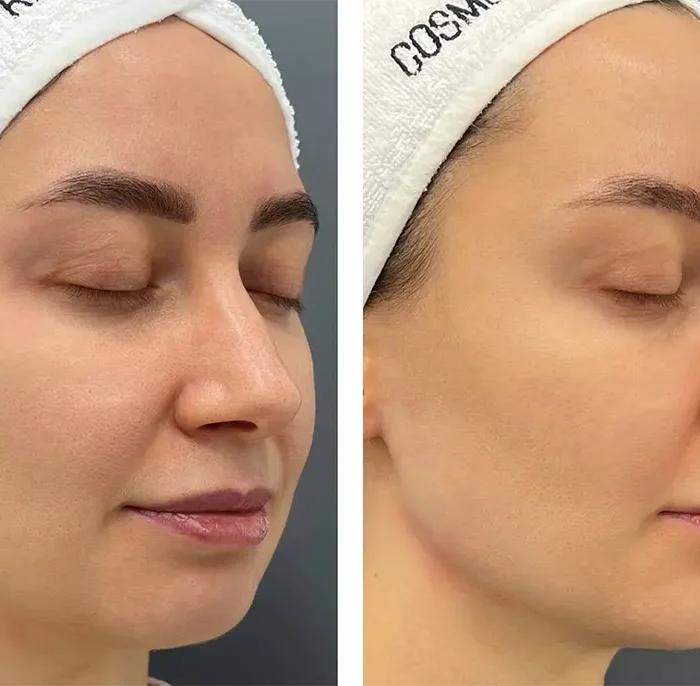 Объемное моделирование лица - Осколкова Анастасия