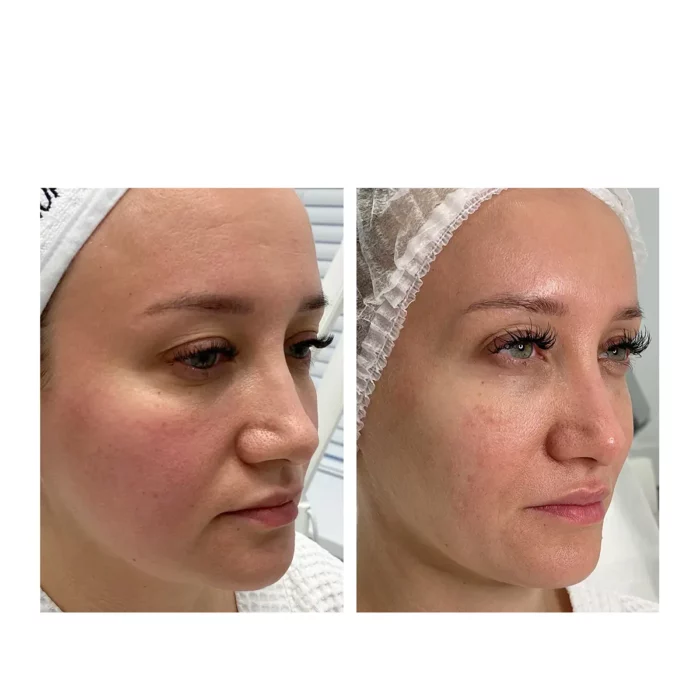 Комплекс процедур