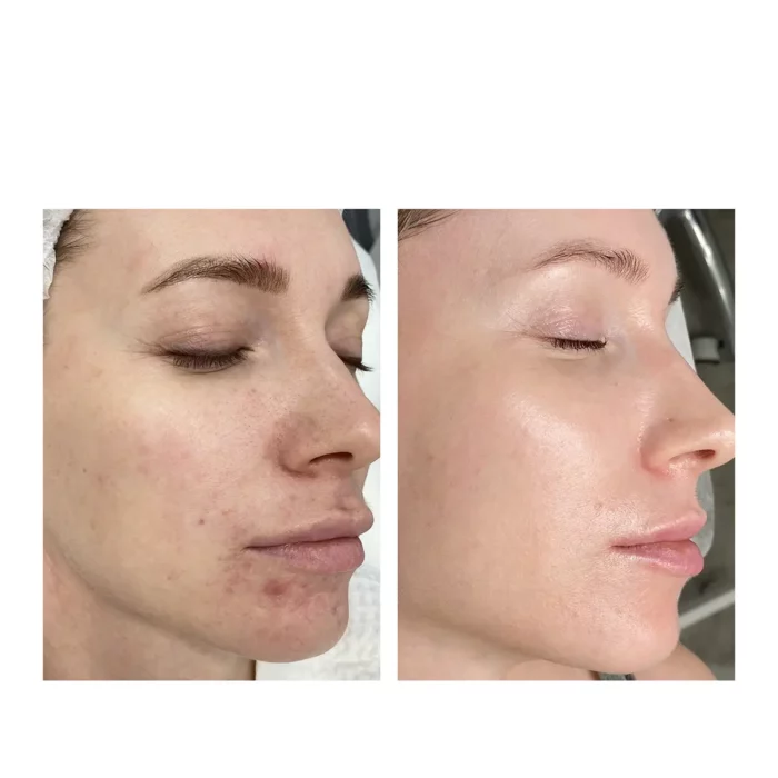 Комплексная терапия anti-age