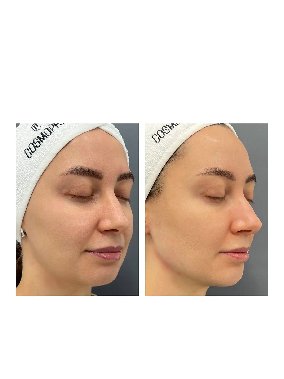 Объемное моделирование лица