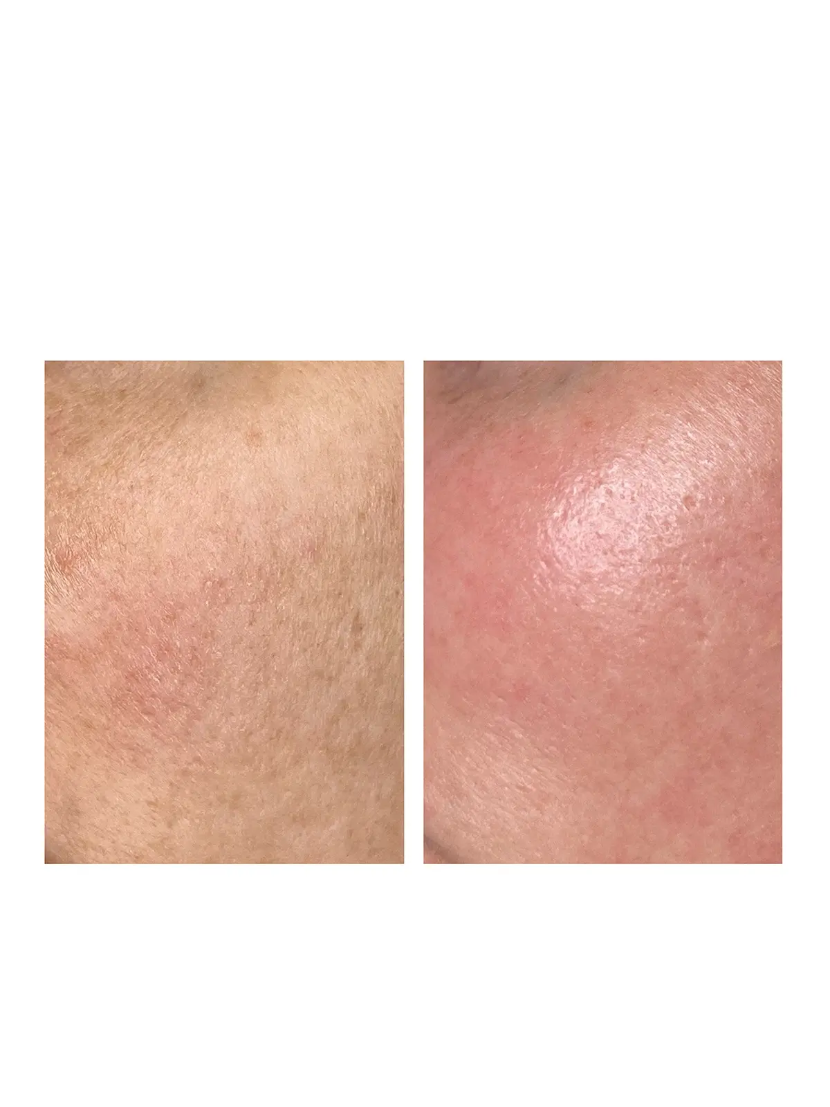 Шлифовка Halo