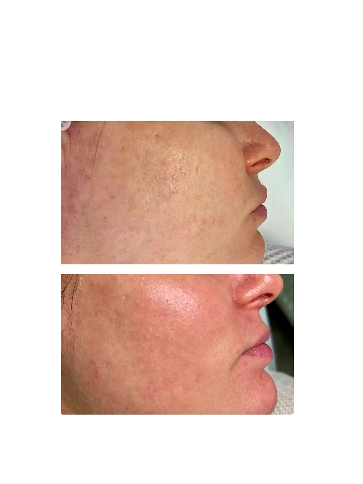 Шлифовка Halo