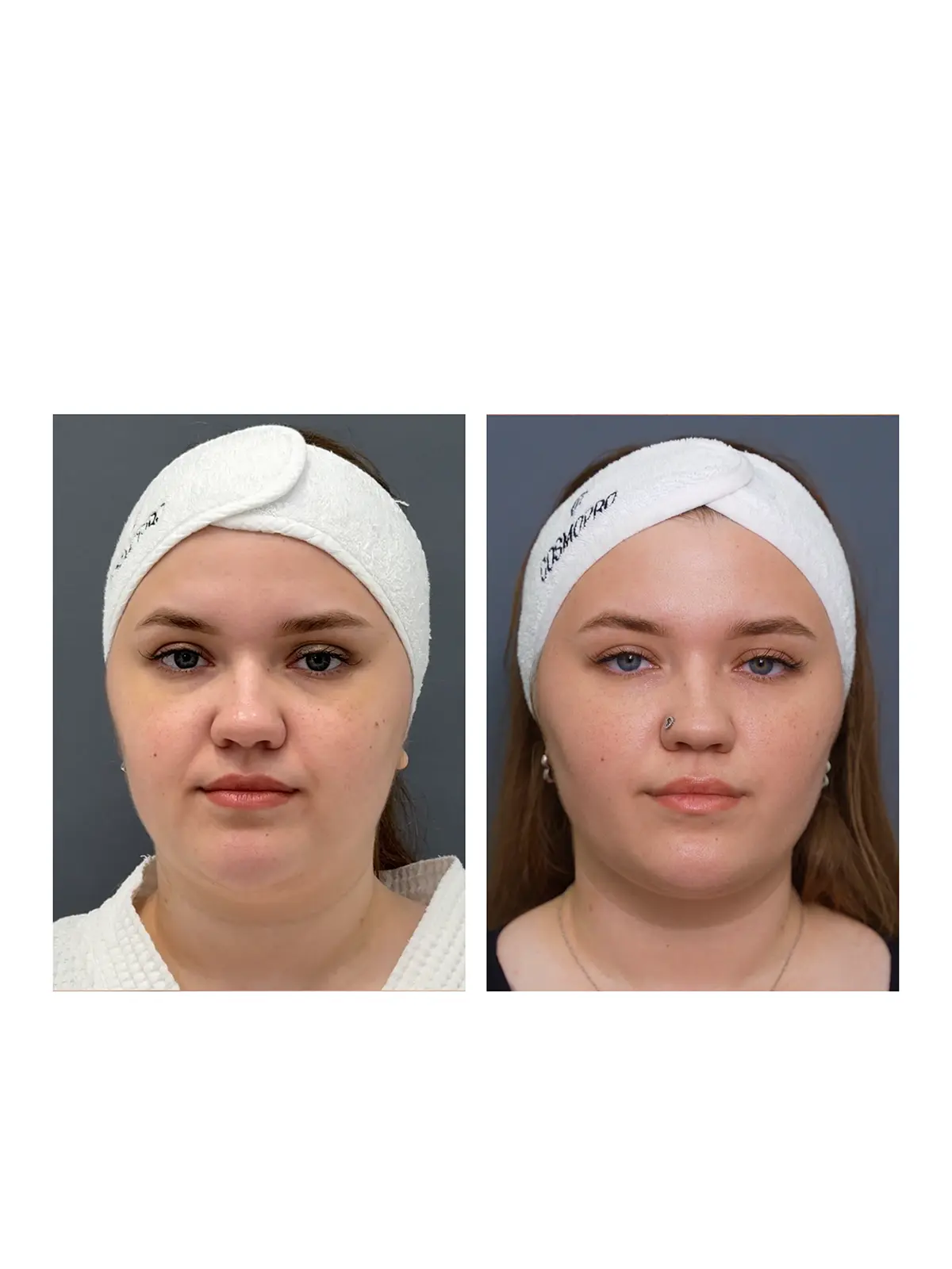 Ультраформер