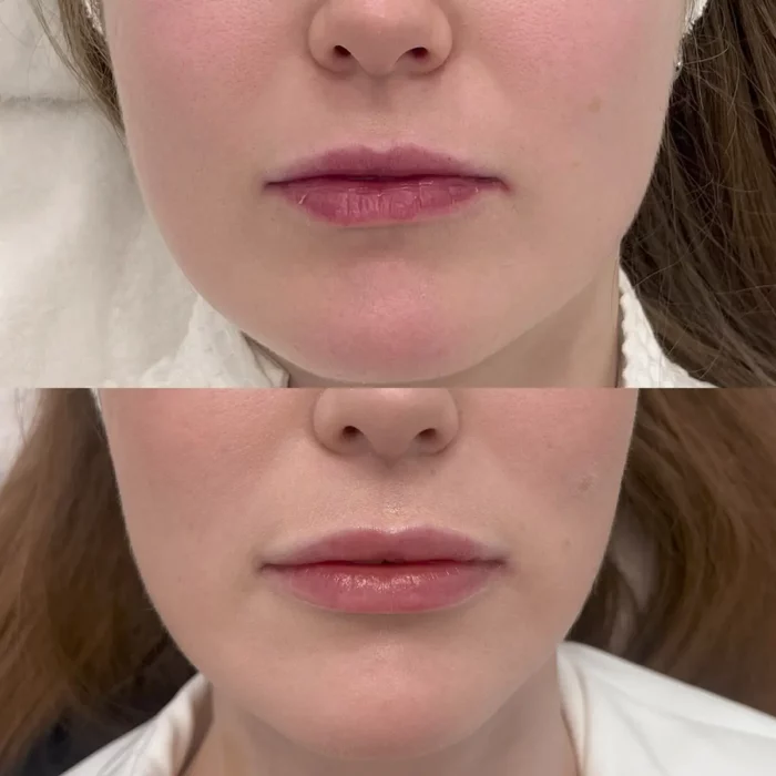 Увлажнение губ